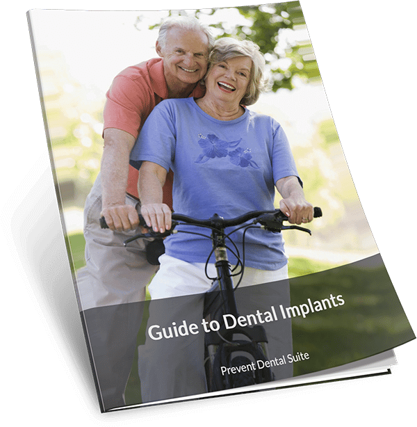 Guide to Dental Implants by PDS