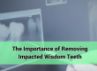 The_Importance_of_Removing_Impacted_Wisdom_Teeth