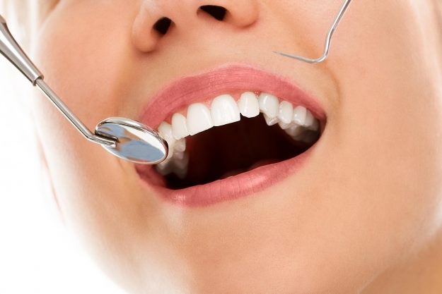 Dentist Kallangur Tips Professional Teeth Cleaning Improves Oral Health