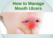 kallangur-dentist-advice-how-to-manage-mouth-ulcers