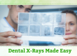 Dental X-Rays Made Easy