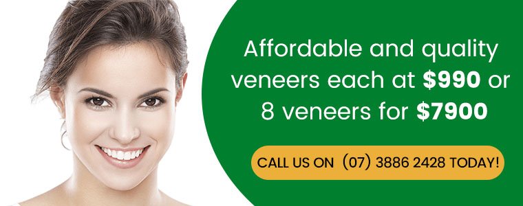 Veneers Promotions Banner Dentist Kallangur