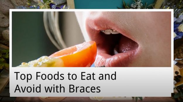 top foods to eat and avoid with braces from prevent dental suite